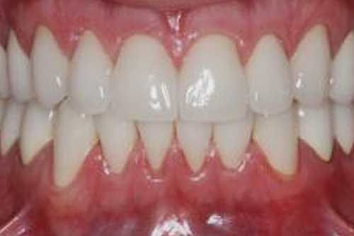 cosmetic dentistry