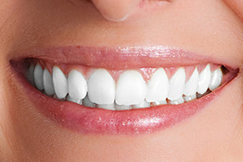 teeth whitening teeth whitening