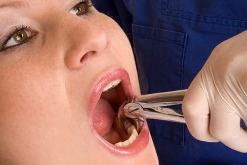 painless dentist painless dentist